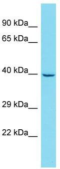 Host: Rabbit; Target Name: GATSL3; Sample Tissue: HepG2 Whole Cell lysates; Antibody Dilution: 1.0 ug/ml