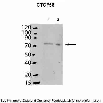 Mouse stem cells expressed in cytoplasm and nucleoplasm. Primary antibody is 1:2000. 20ug lysate added to each lane. Lane 1: Mouse stem cell cytoplasm. Lane 2: Mouse stem cell nucleoplasm.