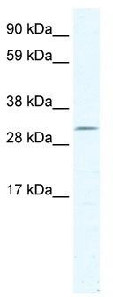 WB Suggested Anti-DMRT2 Antibody Titration: 2.5 ug/ml; ELISA Titer: 1:1562500; Positive Control: SP2/0 cell lysate
