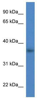 WB Suggested Anti-Lgals4 Antibody Titration: 0.2-1 ug/ml; ELISA Titer: 1: 1562500; Positive Control: Mouse Brain