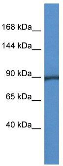 WB Suggested Anti-Pygm Antibody; Titration: 1.0 ug/ml; Positive Control: Mouse Heart