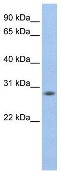 WB Suggested Anti-FKSG24 Antibody Titration: 0.2-1 ug/ml; ELISA Titer: 1: 62500; Positive Control: Human Muscle