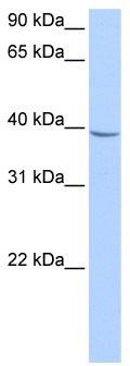WB Suggested Anti-NUDT17 Antibody Titration: 0.2-1 ug/ml; Positive Control: HepG2 cell lysate