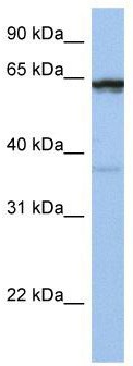 WB Suggested Anti-POPDC2 Antibody Titration: 0.2-1 ug/ml; Positive Control: Jurkat cell lysate