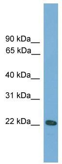 WB Suggested Anti-Rgs1 Antibody Titration: 0.2-1 ug/ml; ELISA Titer: 1:1562500; Positive Control: Mouse Uterus
