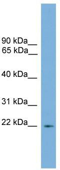 WB Suggested Anti-Rgs10 Antibody Titration: 0.2-1 ug/ml; ELISA Titer: 1:1562500; Positive Control: Mouse Thymus