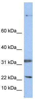 WB Suggested Anti-SEP15 Antibody Titration: 0.2-1 ug/ml; Positive Control: HepG2 cell lysate