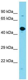 Host: Rabbit; Target Name: GPATCH2L; Sample Tissue: Fetal Brain lysates; Antibody Dilution: 1.0ug/ml