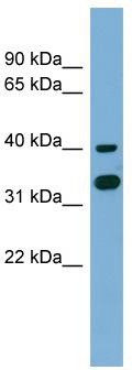 WB Suggested Anti-GPN2 Antibody Titration: 0.2-1 ug/ml; ELISA Titer: 1:312500; Positive Control: NCI-H226 cell lysate