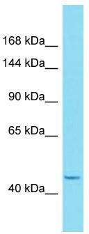 Host: Rabbit; Target Name: HEATR6; Sample Tissue: 721_B Whole Cell lysates; Antibody Dilution: 1.0 ug/ml