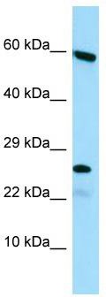Host: Rabbit; Target Name: HGSNAT; Sample Tissue: HepG2 Whole Cell lysates; Antibody Dilution: 1.0 ug/ml HGSNAT is supported by BioGPS gene expression data to be expressed in HepG2