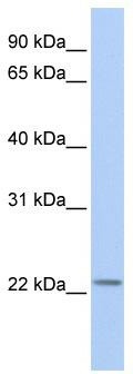WB Suggested Anti-HIST1H1T Antibody Titration: 0.2-1 ug/ml; ELISA Titer: 1: 1562500; Positive Control: Human heart