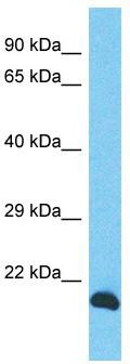 Host: Rabbit; Target Name: INO80C; Sample Tissue: PANC1 Whole cell lysates; Antibody Dilution: 1.0 ug/ml