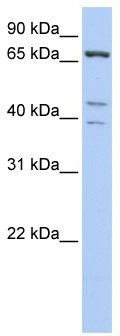 WB Suggested Anti-IPP Antibody Titration: 0.2-1 ug/ml; ELISA Titer: 1: 1562500; Positive Control: Hela cell lysate