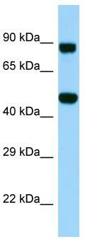 Host: Rabbit; Target Name: KDELC2; Sample Tissue: PANC1 Whole Cell lysates; Antibody Dilution: 1.0 ug/ml