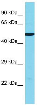 Host: Rabbit; Target Name: KRT38; Sample Tissue: Hela Whole Cell lysates; Antibody Dilution: 1.0ug/ml