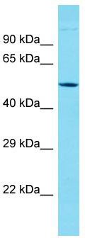 Host: Rabbit; Target Name: KRT38; Sample Tissue: Jurkat Whole Cell lysates; Antibody Dilution: 1.0ug/ml