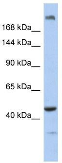 WB Suggested Anti-KIAA0284 Antibody Titration: 0.2-1 ug/ml; ELISA Titer: 1: 312500; Positive Control: Human Muscle