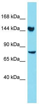 Host: Rabbit; Target Name: CLUH; Sample Tissue: 293T Whole Cell lysates; Antibody Dilution: 1.0 ug/ml