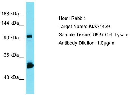 Host: Rabbit; Target Name: KIAA1429; Sample Tissue: U937 Whole Cell lysates; Antibody Dilution: 1.0 ug/ml