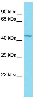 Host: Rabbit; Target Name: KIAA1539; Sample Tissue: Hela Whole cell lysates; Antibody Dilution: 1.0 ug/ml