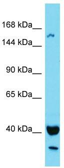 Host: Rabbit; Target Name: KIAA1683; Sample Tissue: MCF7 Whole Cell lysates; Antibody Dilution: 1.0 ug/ml