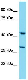 Host: Rabbit; Target Name: MSANTD4; Sample Tissue: A549 Whole Cell lysates; Antibody Dilution: 1.0 ug/ml