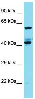 Host: Rabbit; Target Name: KIAA1841; Sample Tissue: A549 Whole Cell lysates; Antibody Dilution: 1.0 ug/ml