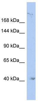WB Suggested Anti-KIF1A Antibody Titration: 0.2-1 ug/ml; ELISA Titer: 1:62500; Positive Control: THP-1 cell lysate