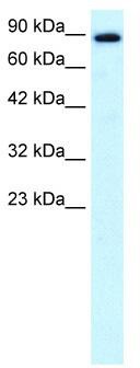 WB Suggested Anti-KIF21A Antibody Titration: 0.2-1 ug/ml; Positive Control: Human brain