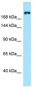 WB Suggested Anti-KIF21B Antibody; Titration: 1.0 ug/ml; Positive Control: Hela Whole Cell