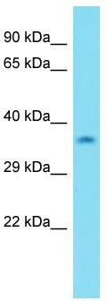 Host: Rabbit; Target Name: C15orf23; Sample Tissue: MDA-MB-435S Whole Cell lysates; Antibody Dilution: 1.0 ug/ml.