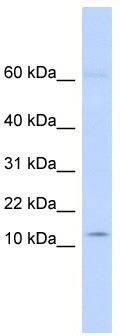 WB Suggested Anti-KRTAP8-1 Antibody Titration: 0.2-1 ug/ml; ELISA Titer: 1: 312500; Positive Control: Human heart