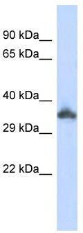 WB Suggested Anti-KRTAP24-1 Antibody Titration: 0.2-1 ug/ml; ELISA Titer: 1: 500; Positive Control: 293T cell lysate