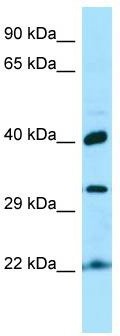 WB Suggested Anti-KTI12 Antibody; Titration: 1.0 ug/ml; Positive Control: Fetal kidney