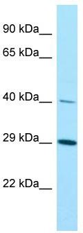 WB Suggested Anti-KTI12 Antibody; Titration: 1.0 ug/ml; Positive Control: A549 Whole Cell