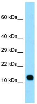 WB Suggested Anti-LCE3C Antibody; Titration: 1.0 ug/ml; Positive Control: Fetal Lung