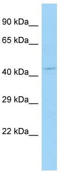 Host: Rabbit; Target Name: LEKR1; Sample Tissue: Jurkat Whole Cell lysates; Antibody Dilution: 1.0ug/ml