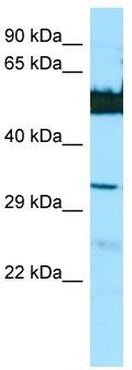 WB Suggested Anti-LGSN Antibody; Titration: 1.0 ug/ml; Positive Control: HepG2 Whole Cell