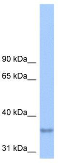 WB Suggested Anti-LPPR2 Antibody Titration: 0.2-1 ug/ml; Positive Control: Hela cell lysate