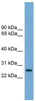 WB Suggested Anti-LRRC3 Antibody Titration: 0.2-1 ug/ml; Positive Control: Human brain