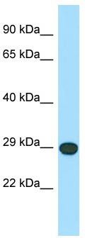 WB Suggested Anti-LRRC10 Antibody; Titration: 1.0 ug/ml; Positive Control: PANC1 Whole Cell