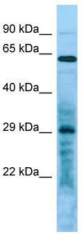 Host: Rabbit; Target Name: LRRC10; Sample Tissue: Hela Whole Cell lysates; Antibody Dilution: 1.0 ug/ml