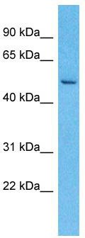 Host: Rabbit; Target Name: LRRC14; Sample Tissue: Esophagus Tumor lysates; Antibody Dilution: 1.0 ug/ml