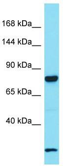 Host: Rabbit; Target Name: LRRC37A; Sample Tissue: Fetal Lung lysates; Antibody Dilution: 1.0 ug/ml