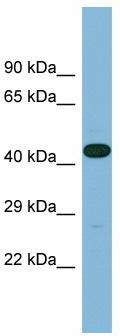 Host: Rabbit; Target Name: LRRC49; Sample Tissue: Fetal Heart lysates; Antibody Dilution: 1.0 ug/ml