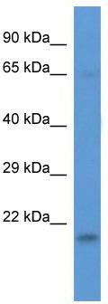 WB Suggested Anti-LSMD1 Antibody; Titration: 1.0 ug/ml; Positive Control: 721_B Whole Cell