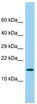 Host: Rabbit; Target Name: LY6G6D; Sample Tissue: Fetal Lung lysates; Antibody Dilution: 1.0 ug/ml