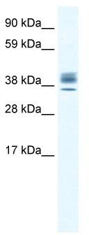 WB Suggested Anti-ESX1 Antibody Titration: 2.5 ug/ml; ELISA Titer: 1:1562500; Positive Control: Human Testis