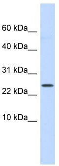 WB Suggested Anti-LYPD6 Antibody Titration: 0.2-1 ug/ml; ELISA Titer: 1: 312500; Positive Control: Human Small Intestine